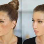 remove dark spots from face naturally