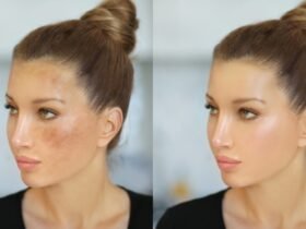 remove dark spots from face naturally
