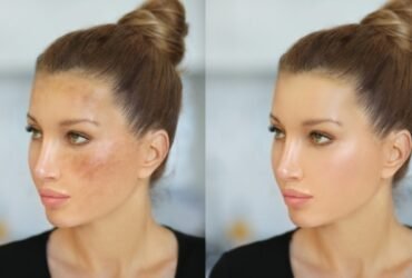 remove dark spots from face naturally